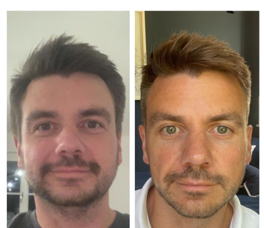 Si i ndryshoi pamja dhe shëndeti pasi filloi të punoj nga shtëpia